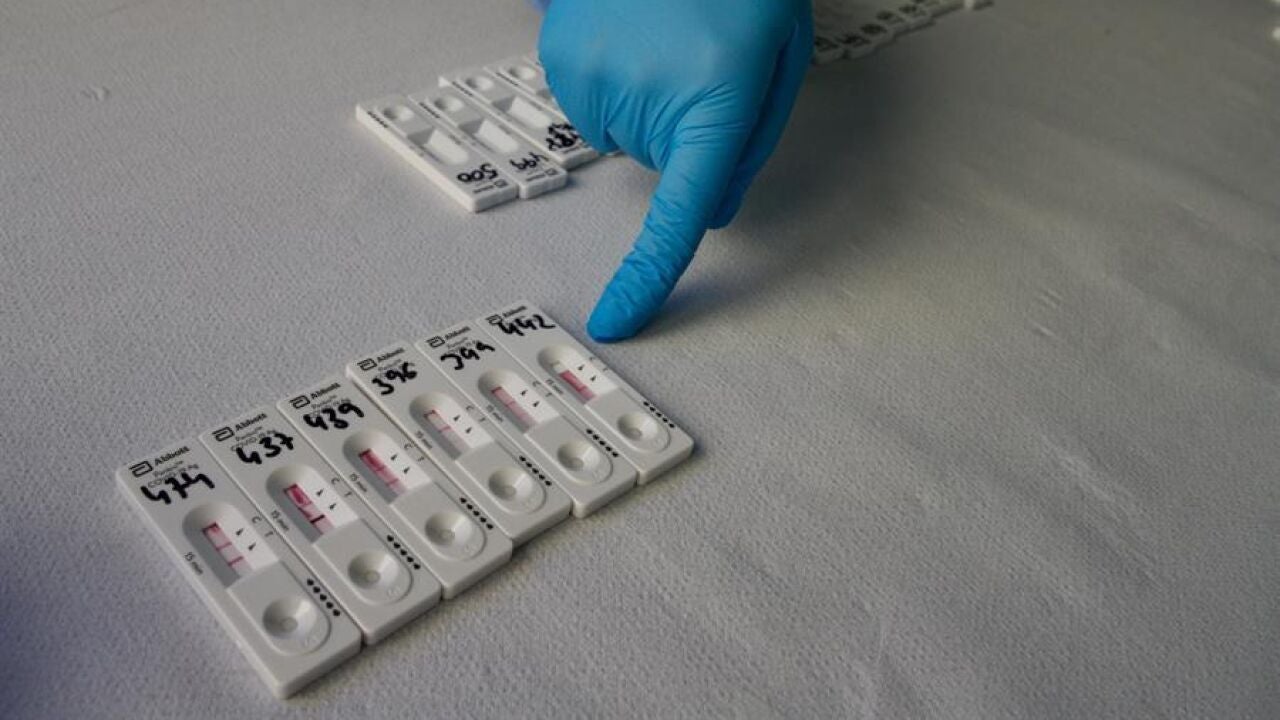 Llegan los tests rápidos de antígenos para detectar la Covid
